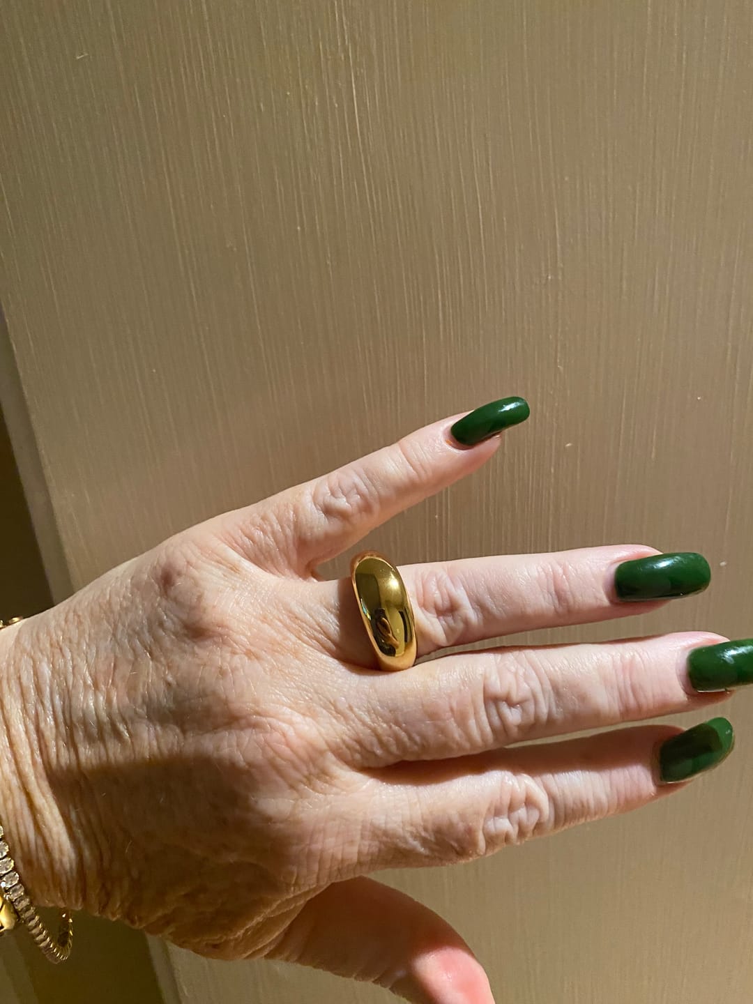 Customer photo review of Chunky Dome Ring