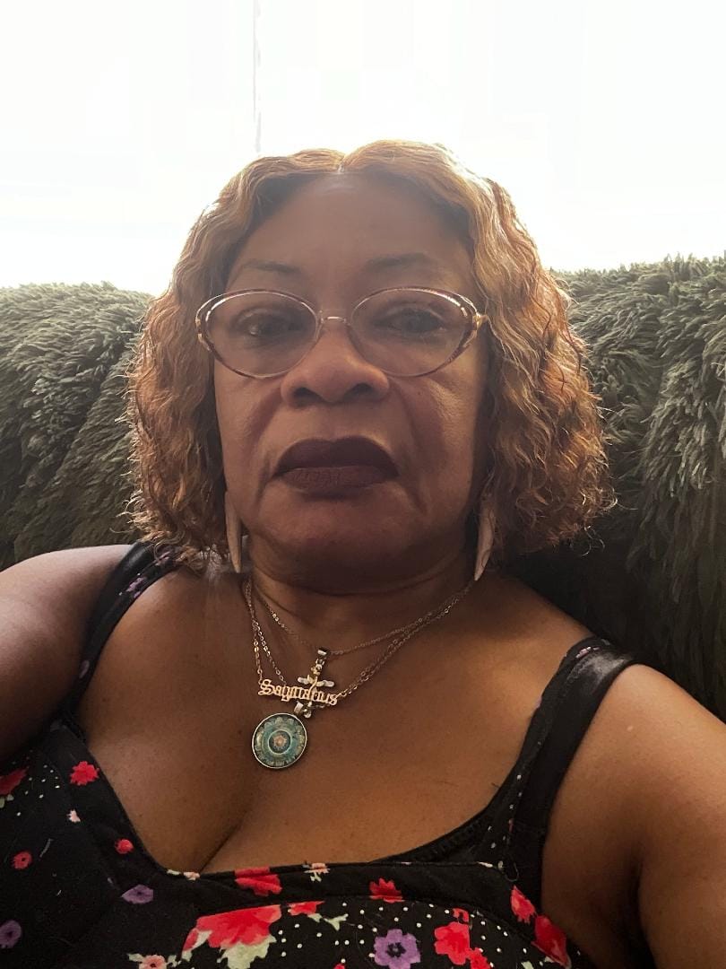 Customer photo review of Carotone Trio Black Spot Corrector Kit 4.4 oz