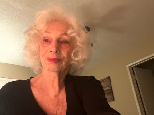 Customer photo review of Grass Fed Tallow & Honey Balm