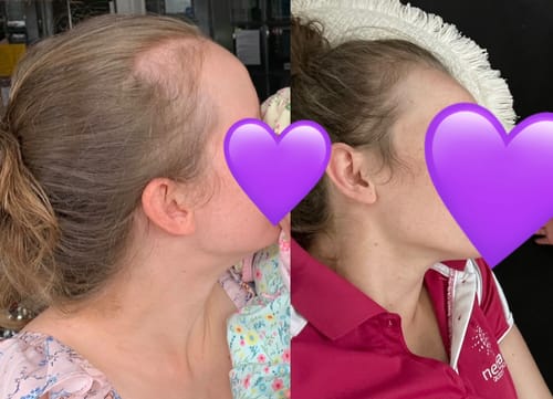 Customer photo review of Unflavoured Collagen