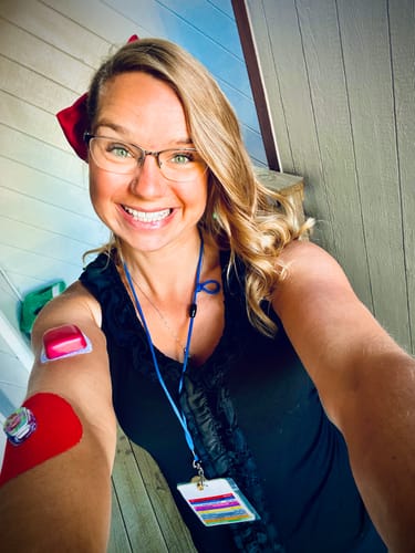 Customer photo review of Skin Grip Original - Omnipod Adhesive Patches