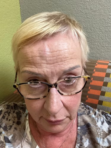 Customer photo review of Grass Fed Tallow & Honey Balm