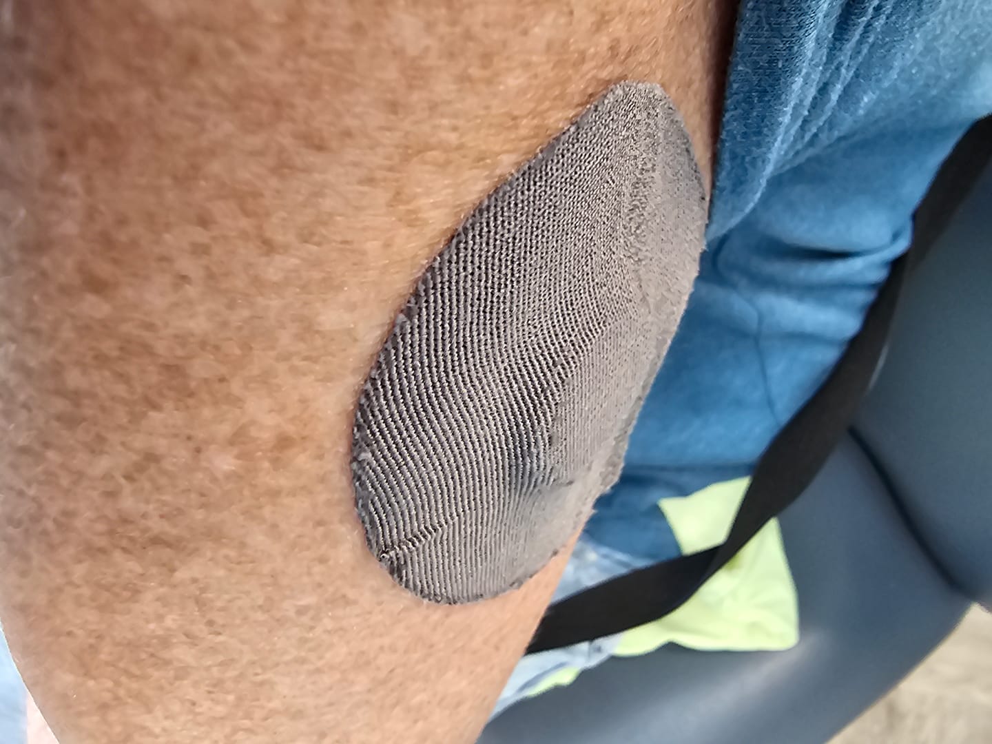 Customer photo review of Skin Grip Original - Dexcom G7 & Stelo Adhesive Patches