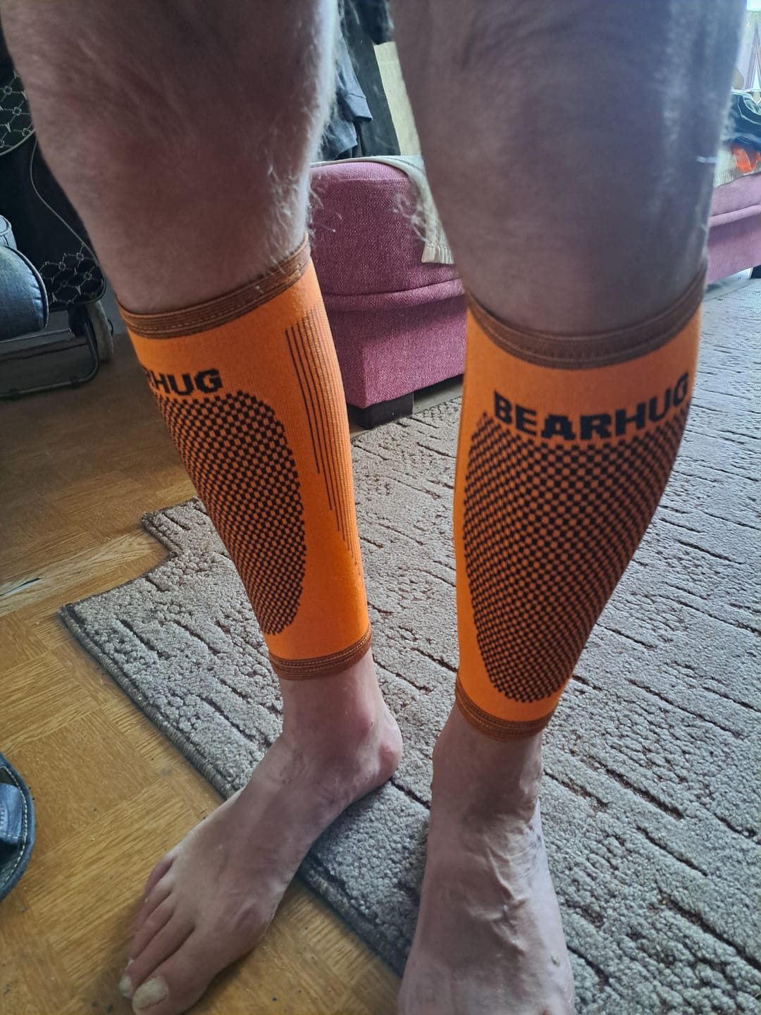 Customer photo review of Pair of Calf Compression Support Sleeves For Shin Splint Pain Relief
