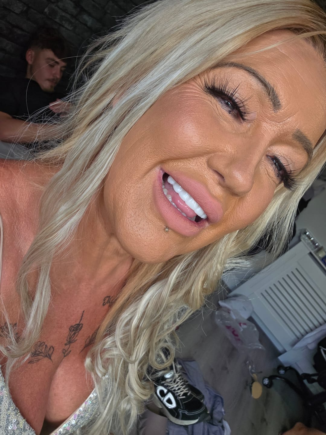 Customer photo review of Click-in Veneers 4.0