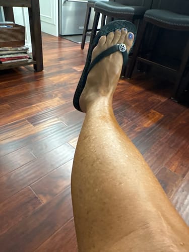 Customer photo review of Besque™ Magic Body Oil - 100ml