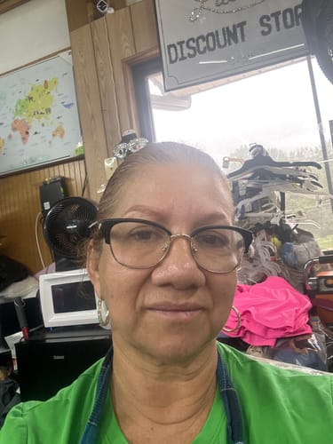 Customer photo review of INIA FLARE Microcurrent Facial Device