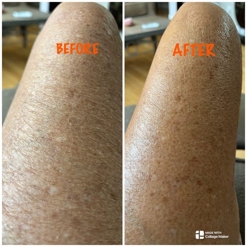 Customer photo review of Body Serum