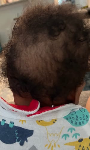 Customer photo review of Infant Collection Kit