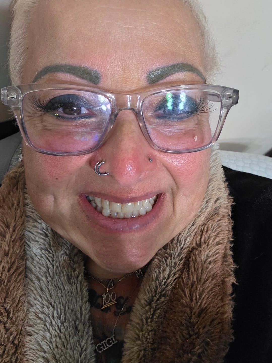 Customer photo review of Premium Lower Retainer