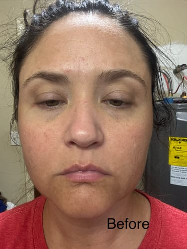 Customer photo review of Neptune Grass Fed Tallow & Honey Balm