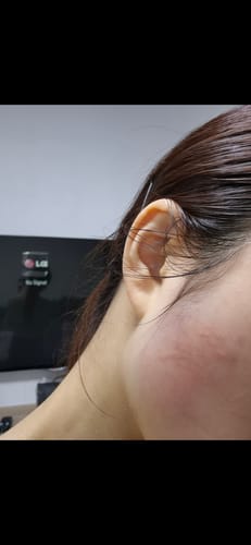 Customer photo review of OUTGLOW - Radiance Tri-Factor™ Jelly