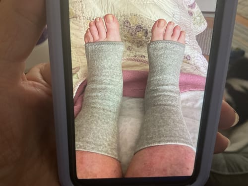 Customer photo review of Premium Anti-Fatigue Bamboo Footsleeves