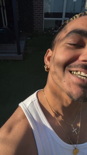 Customer photo review of LUXURA (GOLD PLATED GRILLZ)