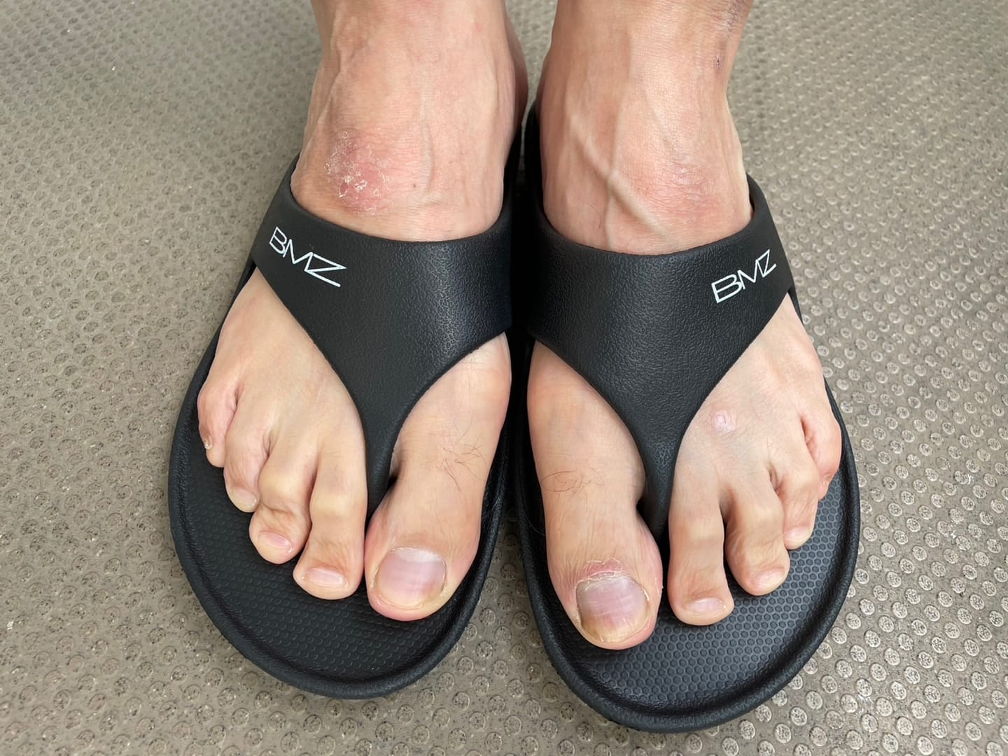 Customer photo review of アシトレサンダル プラス｜リカバリーサンダル