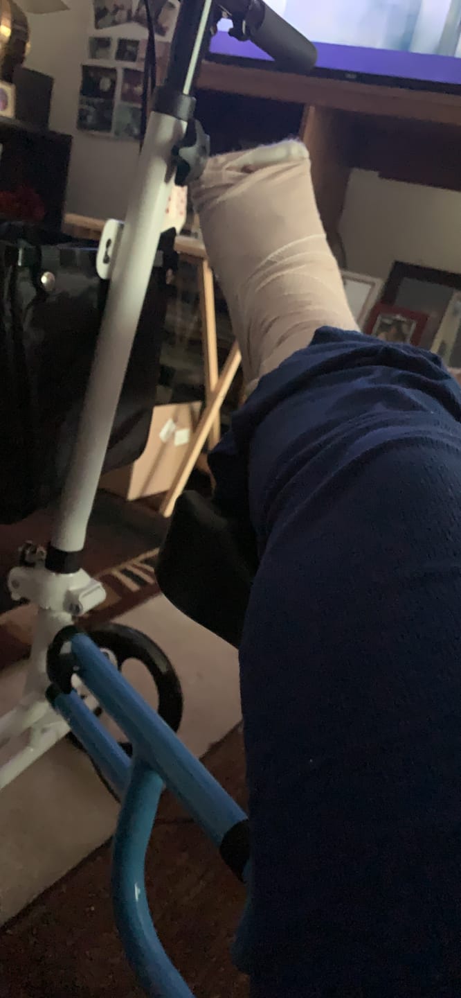 Customer photo review of MT-9251 Best Value Steerable Medical Knee Walker with 10" Wheels