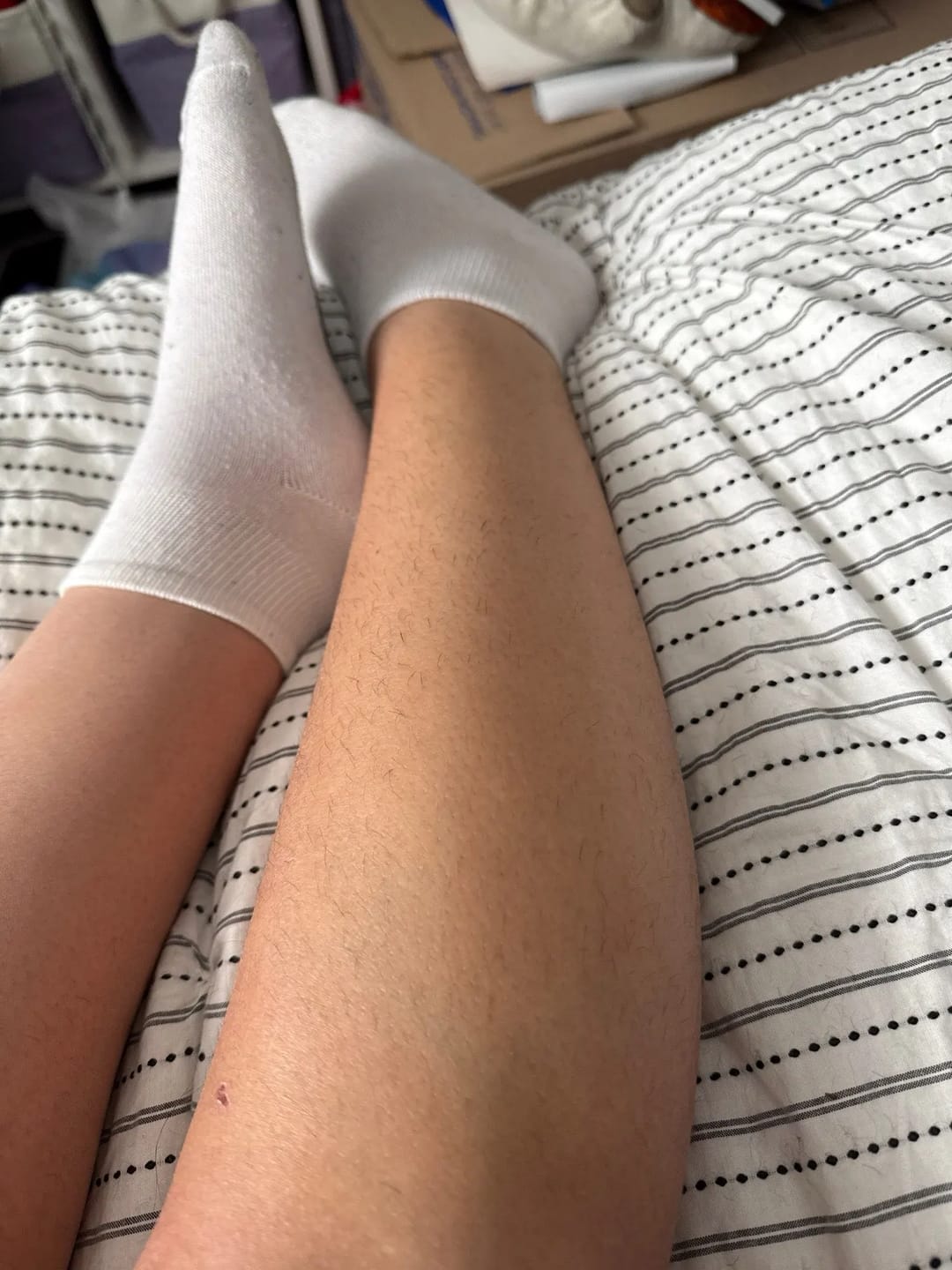 Customer photo review of SkinCare- Epilator sa kristalima