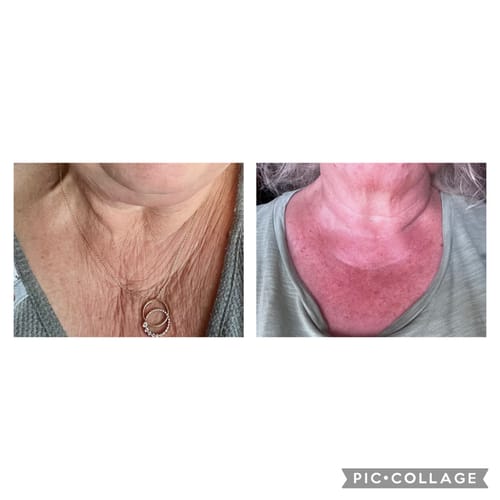 Customer photo review of Besque™ Magic Body Oil - 100ml