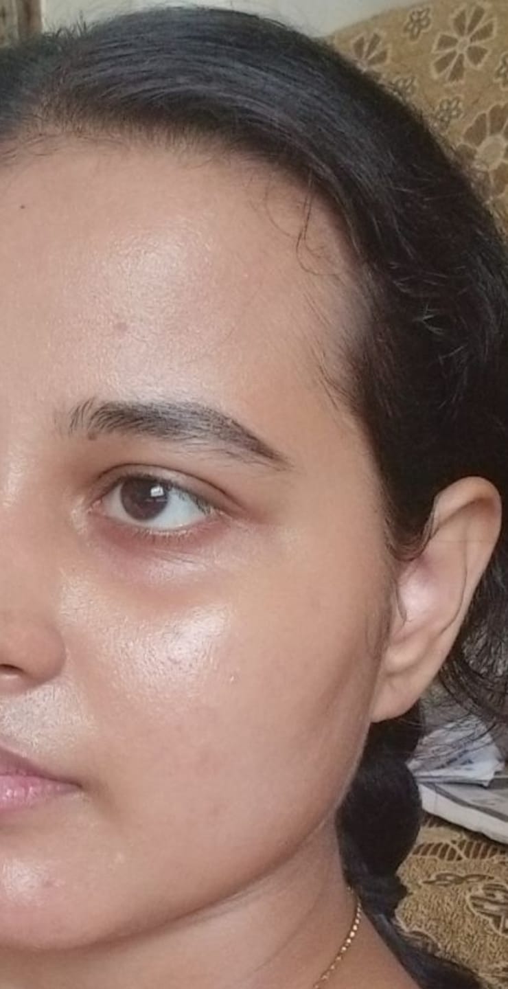 Customer photo review of Ujvala Skin Brightening Moisturizer