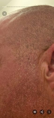 Customer photo review of Seb Natural Calming Serum