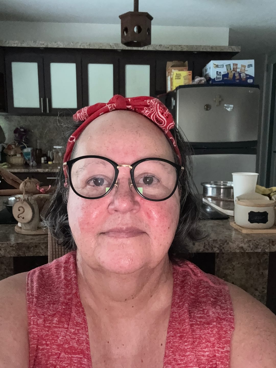 Customer photo review of Moisturizer cream with  Hyaluronic Acid