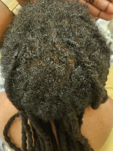 Customer photo review of Rennora Hair Growth Serum