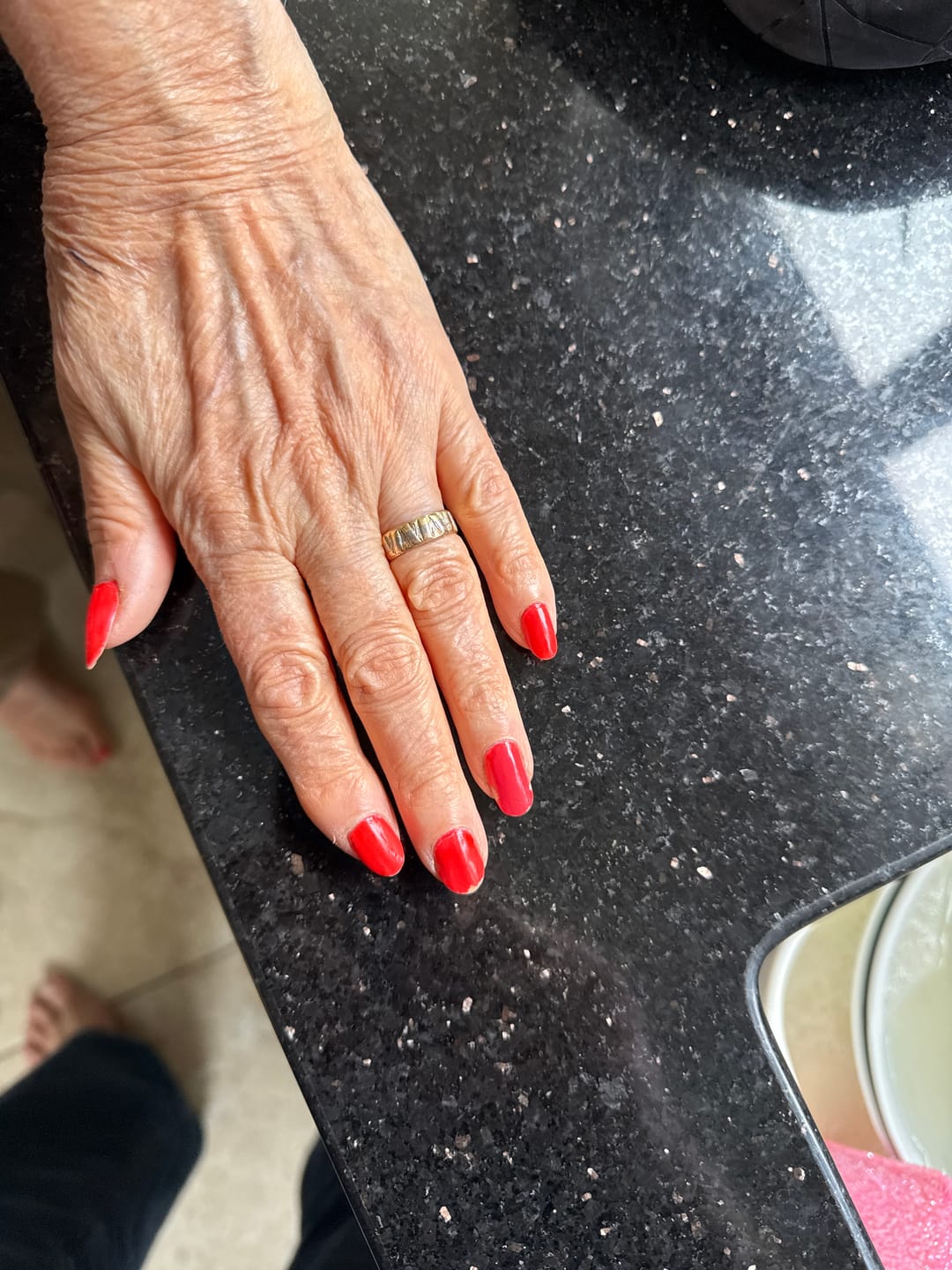 Customer photo review of Podopharm Therapy Onygen Cream with Colostrum for Damaged and Weakened Nails 20ml