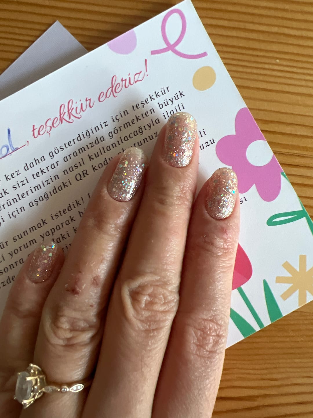 Customer photo review of N Sparkle Glam Jel Tırnak 30 Adet, 2 Kullanım