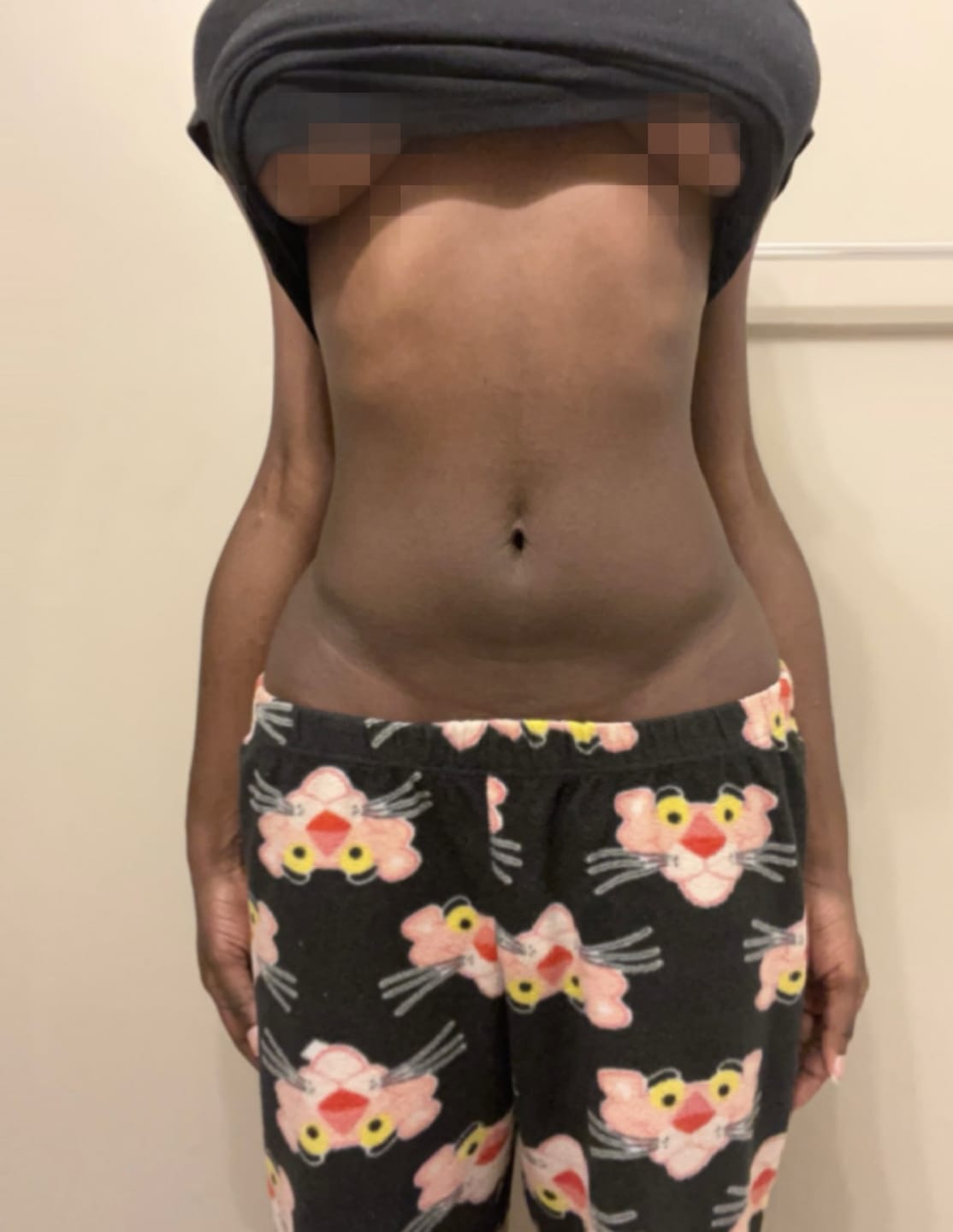 Customer photo review of Double Snatch
