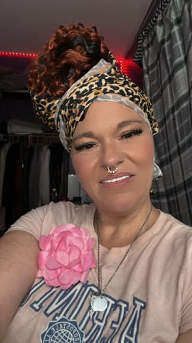 Customer photo review of Payment Plan - Pop On Veneers - With At Home Impression Kit