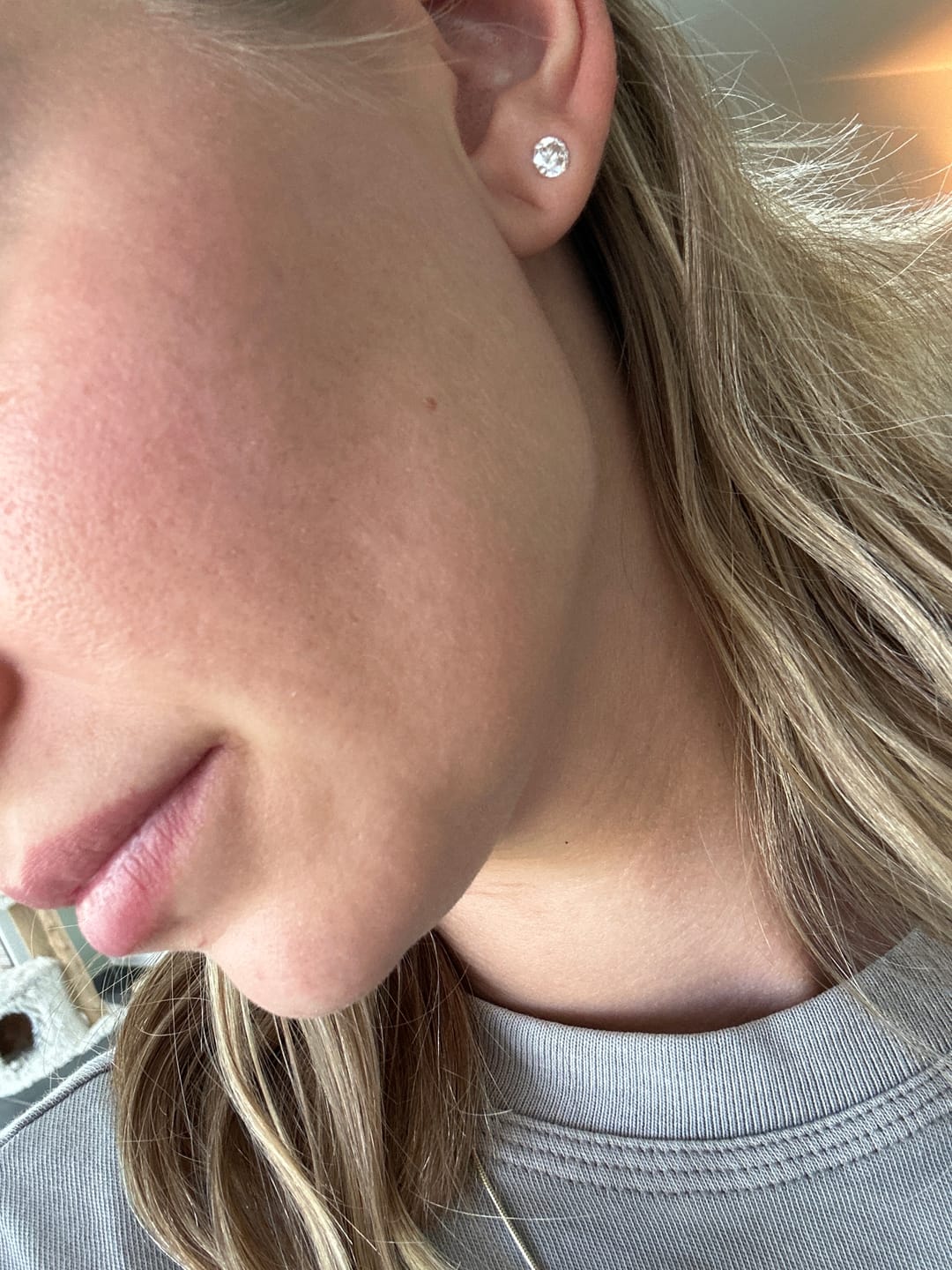 Customer photo review of Purifying Cleanser