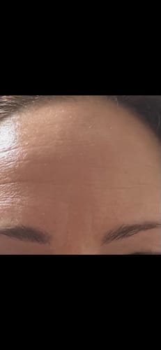 Customer photo review of Sérum de Exosomas Ultra Rejuvenecedor con Bioexosomas de Bakuchiol