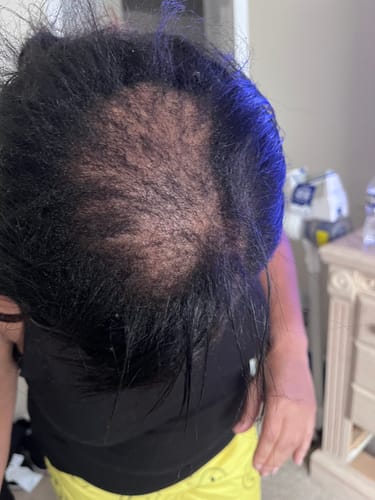 Customer photo review of Super Grow Grease - Scalp Revitalizing Balm