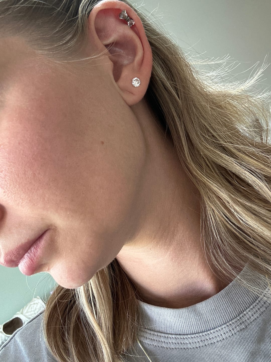 Customer photo review of Soothe & Repair Moisturizer