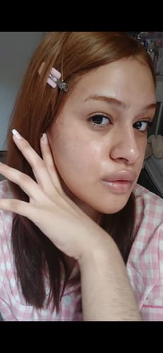 Customer photo review of Collagen Niacinamide Jelly Cream