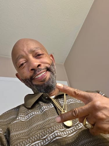 Customer photo review of Pop On Veneers with Impression Kit