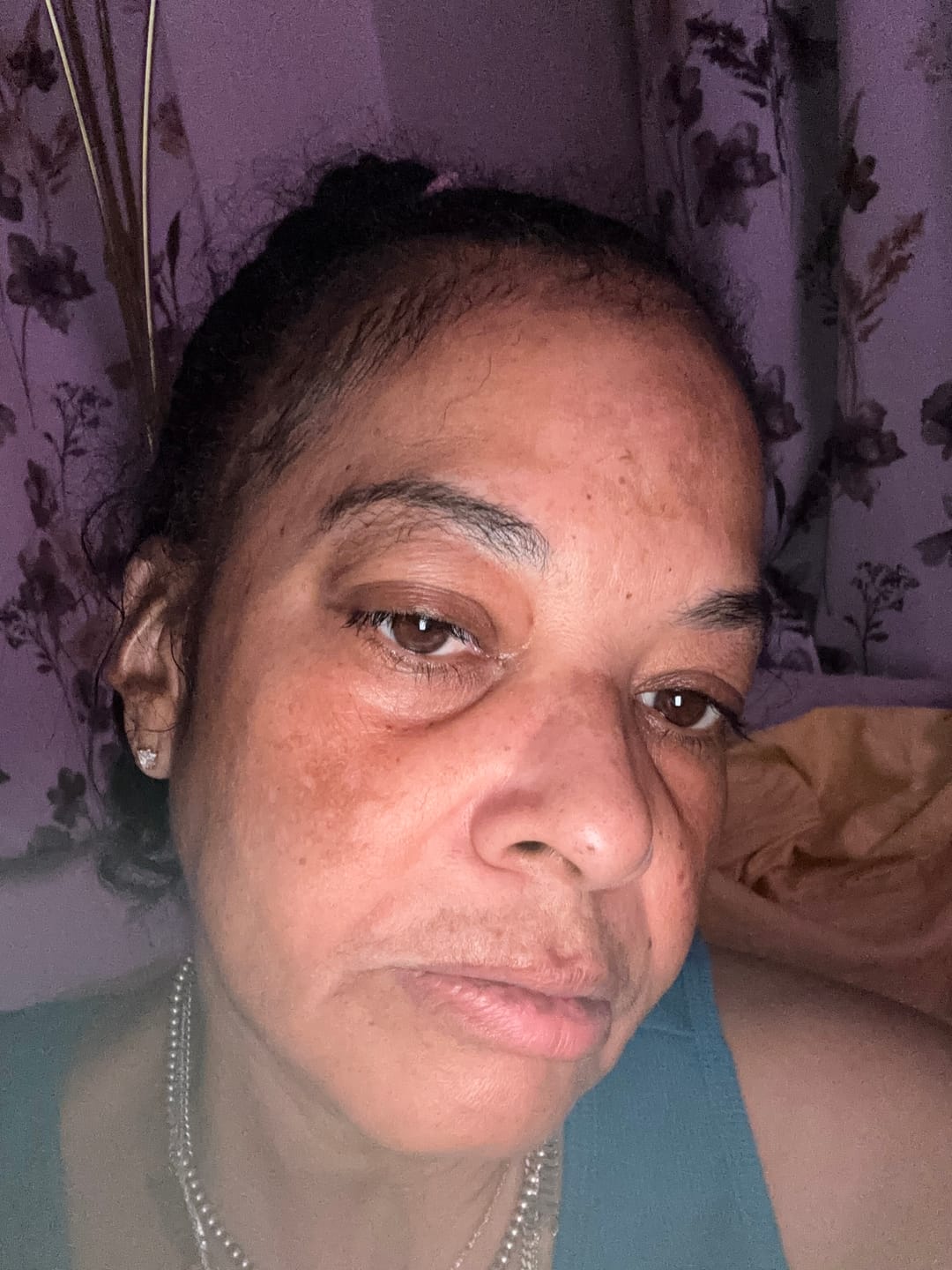 Customer photo review of Melanin Skin Bundle (40% off)