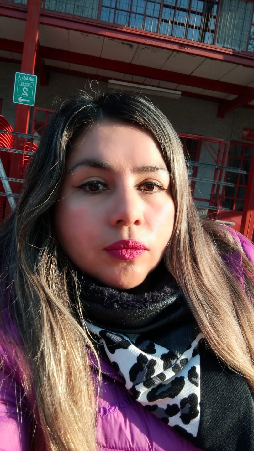 Customer photo review of Delicate Touch - Emulsión Recuperadora | Para pieles con dermatitis, rosácea y sensibilidad extrema | Alivio Real