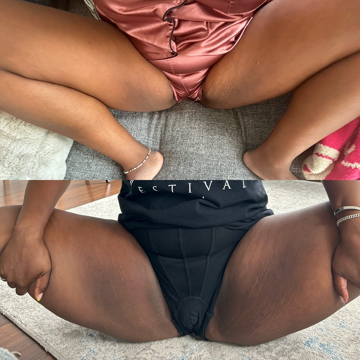 Customer photo review of Magic Eraser Dark Spot Cream