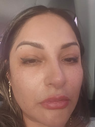Customer photo review of Sérum de Exosomas Ultra Rejuvenecedor con Bioexosomas de Bakuchiol