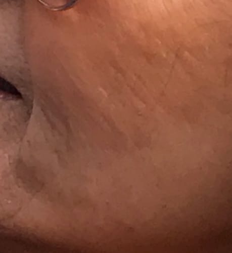 Customer photo review of Grass Fed Tallow & Honey Balm