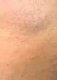Customer photo review of Smoothskin IPL Pure Fit V2