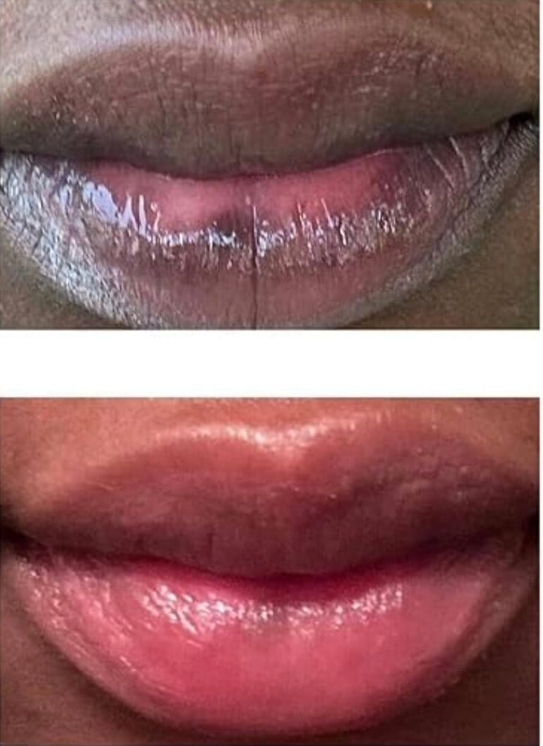 Customer photo review of Pink Lip Kit