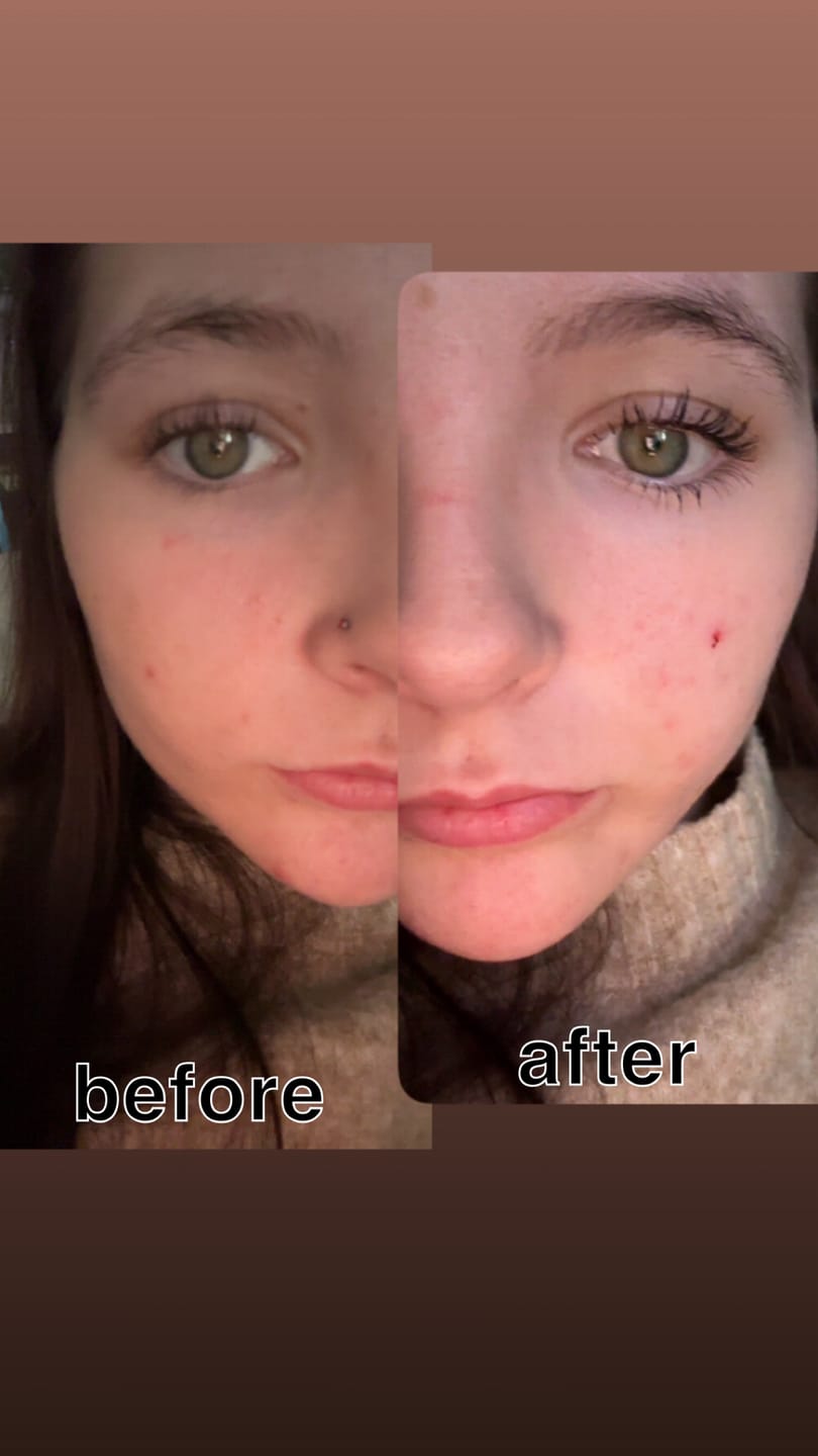 Customer photo review of PRE ORDER Tubing Peptide Mascara Estimated Shipping 25th July