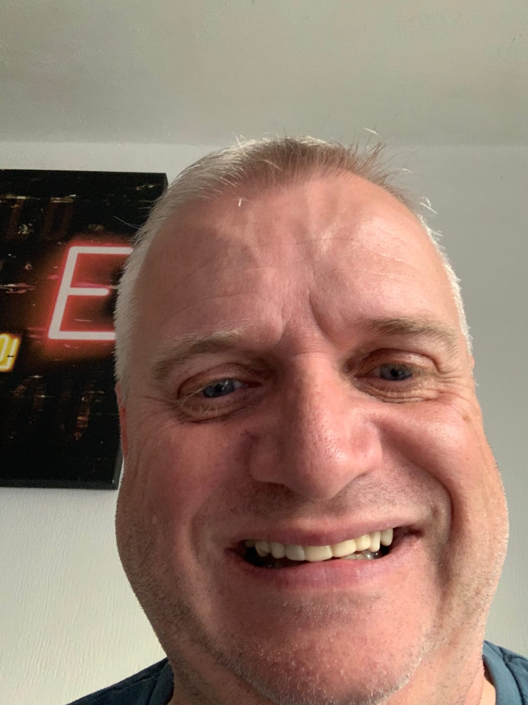 Customer photo review of Click-in Veneers 4.0