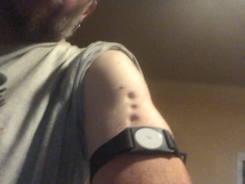 Customer photo review of Freestyle Libre 2 Armband in a Tin Box with 5 stickers - Dia-Style Special Edition PLAIN COLORS