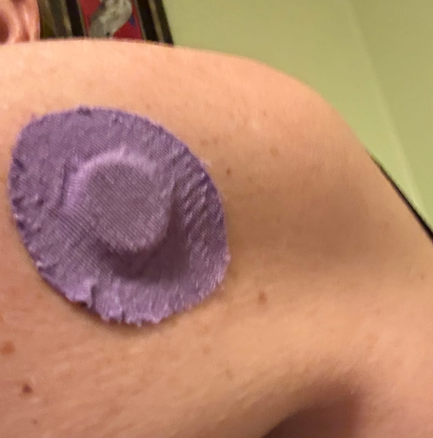 Customer photo review of Skin Grip Original - Libre 3 Adhesive Patches