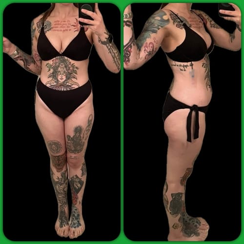 Customer photo review of Semaglutide Weight Loss Program