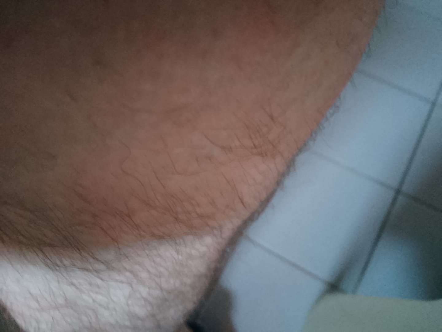 Customer photo review of Haarentfernungsschaum + Body Lotion