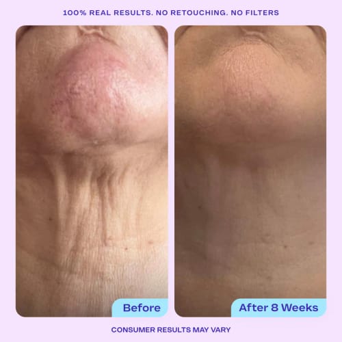 Customer photo review of Tighten & Lift Neck Cream